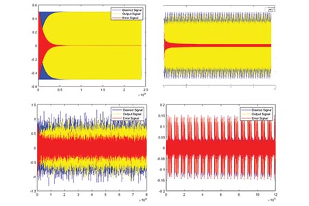 Reducing noise in today’s intensive care units 