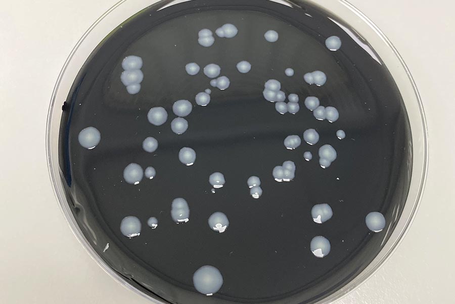 How to address positive Legionella test results